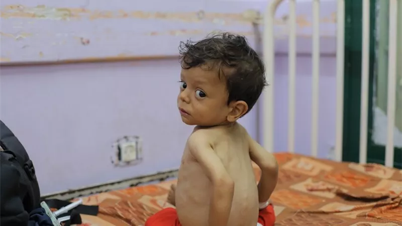 أكثر من 15 ألف مريض في غزة بحاجة لإجلاء طبي عاجل