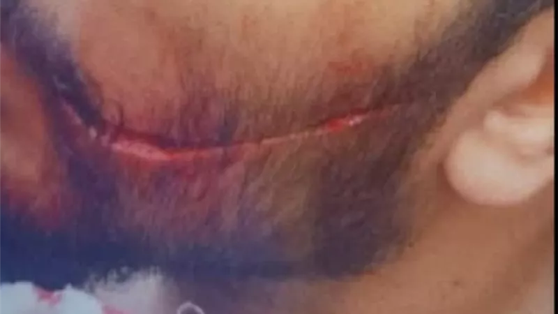 اعتداء وجرح قطعي..عرض طبيب الامتياز بمستشفى سيد جلال على الطب الشرعي