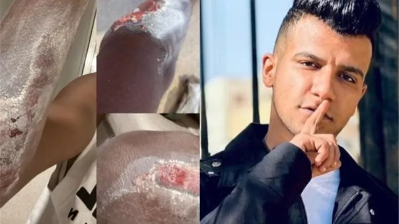 إصابة عصام صاصا بجروح خطيرة في القدم والأيد