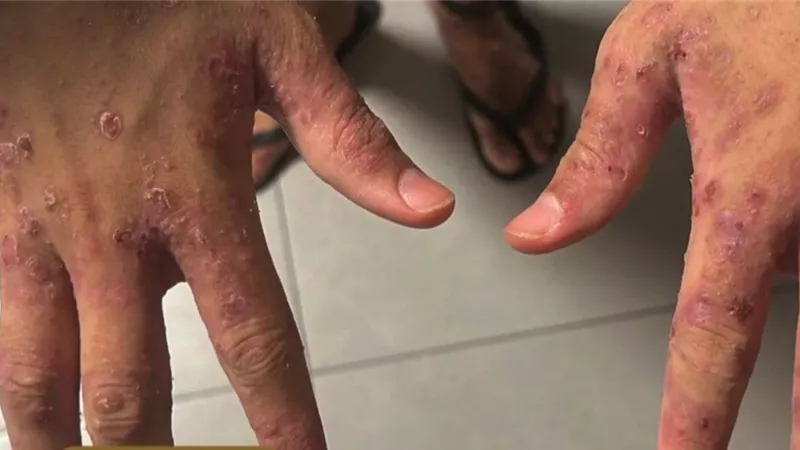 الدماء تسيل من أجسادهم.. إسرائيل تعذب الأسرى الفلسطينيين بـ
