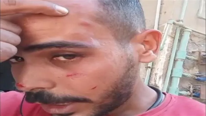 بسبب أولوية المرور.. سائق ميكروباص يتعدى بالضرب على كابتن «أوبر»