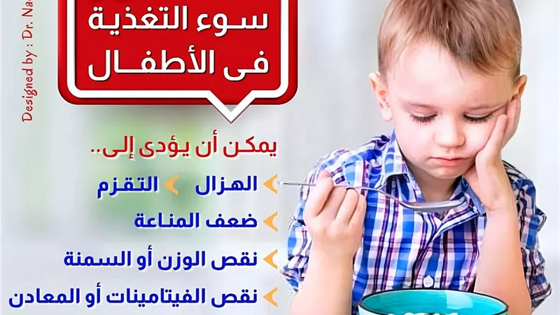 مستشفي دسوق تقدم دراسة علمية عن سوء التغذية لدي الأطفال
