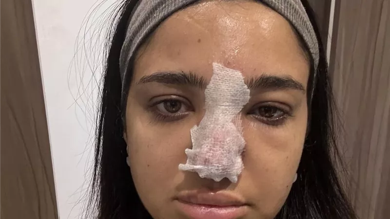 بعد حادث البلوجر كنزى مدبولى مع حقن الفيلر.. تعرف على مخاطرها ومضاعفاتها