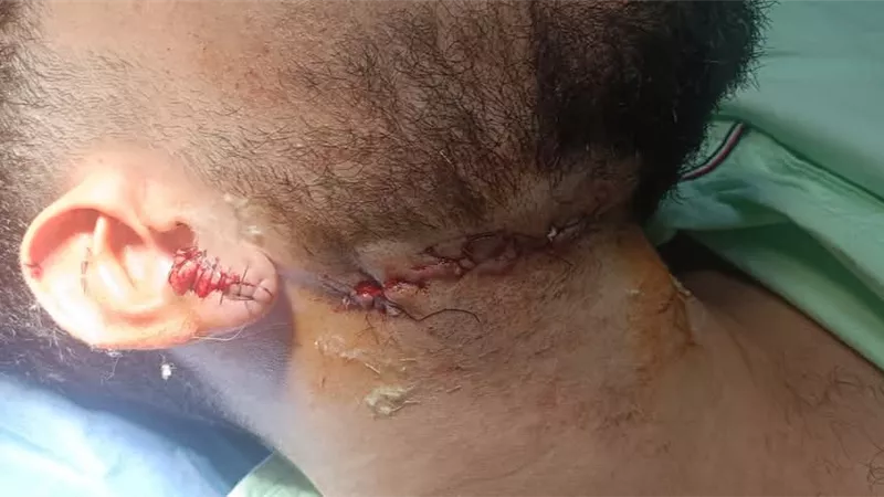 ضربوه بكوب زجاجي.. خلاف على المرور ينتهي بجريمة خطيرة في شبرا الخيمة  