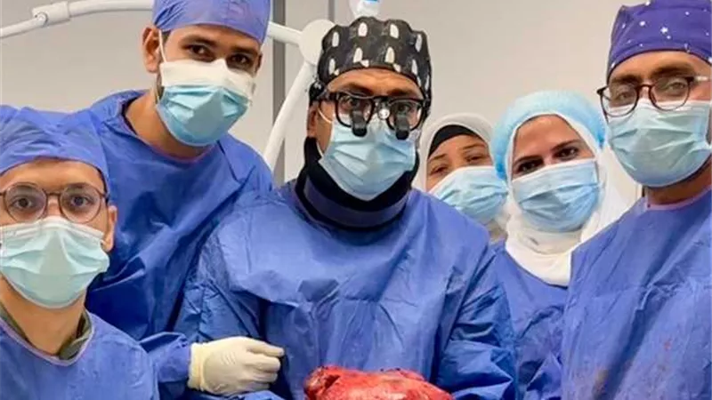 مستشفى السلام ببورسعيد ينجح في استئصال ورم يزن 6 كيلوجرامات من سيدة