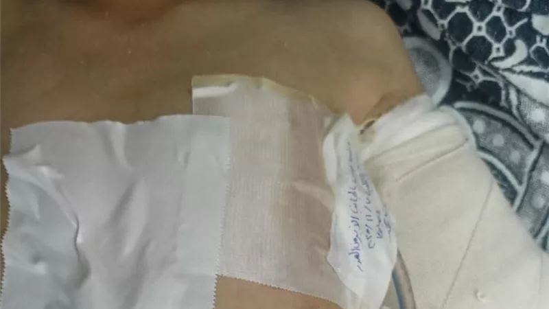 مستشفى دمياط العام ينجح في إنقاذ حياة طفل مصاب بنزيف حاد