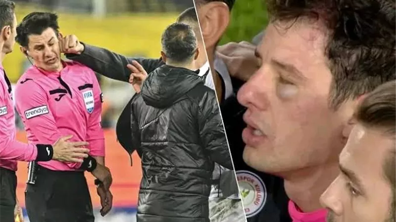 ضربوه في الدوري التركي.. 7 معلومات عن حكم نهائي السوبر بين الأهلي والزمالك