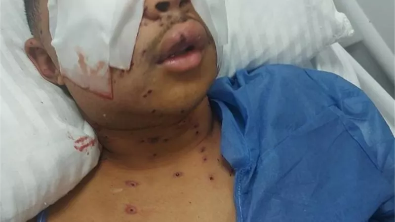 «نفسي أرجع أشوف».. بورسعيدي يكشف تفاصيل الاعتداء عليه بطلقات خرطوش