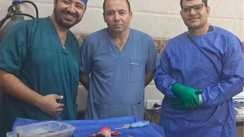 مستشفيات جامعة بني سويف تنجح في جراحة كبرى لتحديد مرحلة ورم خبيث 