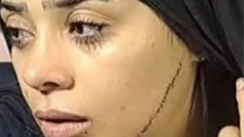 «قبل محاكمتها»|التهم الموجهة للمتهمة بتشويه عروس مصر القديمة بـ«41 غرزة»