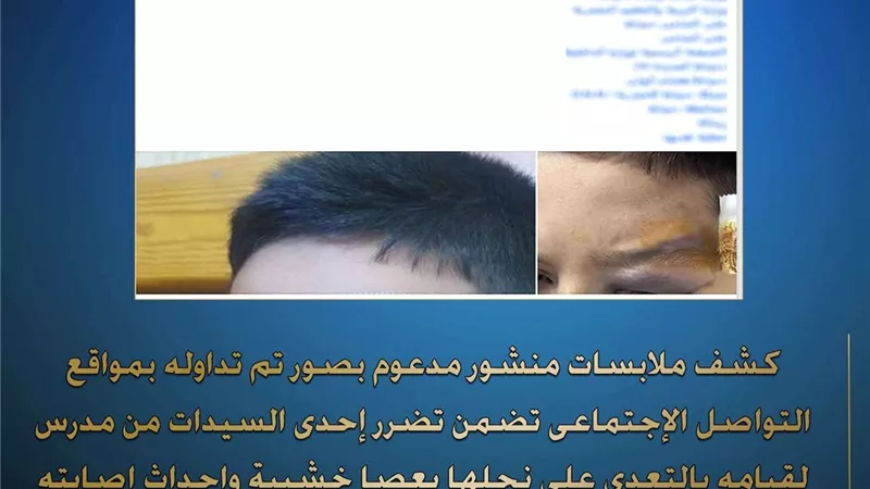 كشف ملابسات تعدي مدرس على طالب بعصا خشبية وإصابته في دمياط 