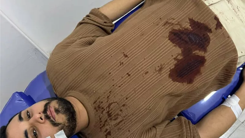 60 غرزة ووجه مشوه.. كواليس اعتداء وحشي على شاب في الدقهلية