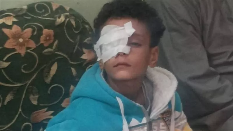 محافظ قنا يوجه بمتابعة حالة طفل فقد عينه على يد معلمته داخل المدرسة