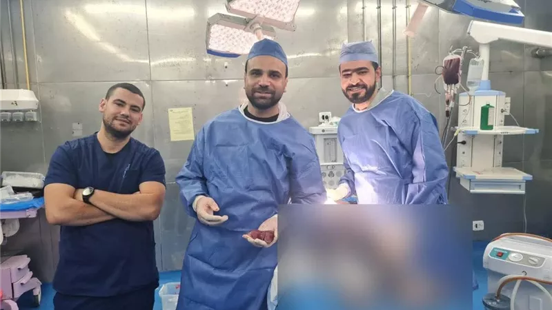 مستشفى دمياط العام تنقذ حياة طفل يعاني نزيفا حاد بعد استئصال الطحال 