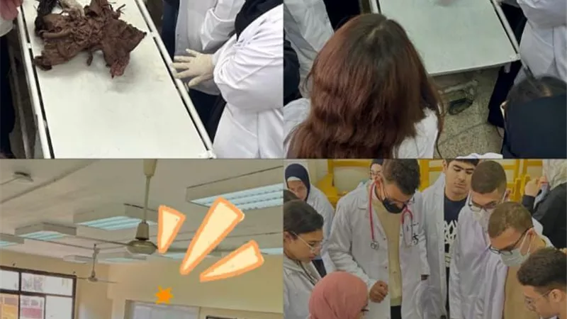 جامعة القاهرة الأهلية تجري تدريبا لطلاب العلاج الطبيعي على التشريح المتقدم