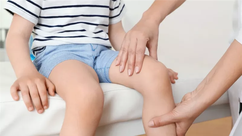 أعراض مرض الكساح عند الأطفال والبالغين.. مؤشرات تحتاج لتدخل طبي سريع 