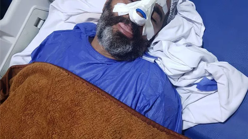   تفاصيل إصابة مدرب حراس أبوقير في مباراة الترسانة