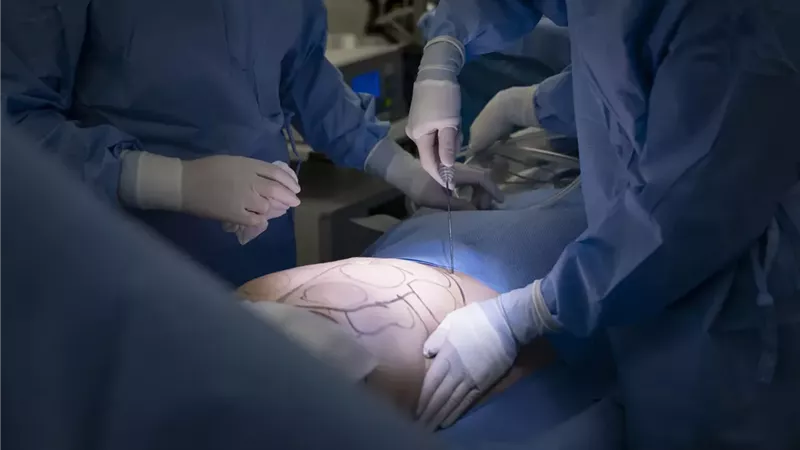  ما حكم إجراء عمليات تحويل النوع؟ أستاذة فقه تجيب