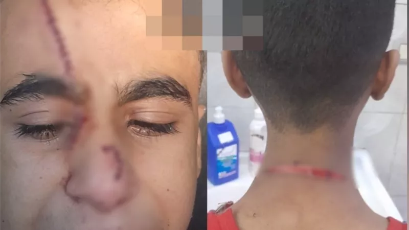 طالب يشوه زميله بـ50 غرزة في الوجه والظهر بالسيدة زينب