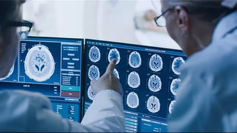 أربع عادات تؤخر شيخوخة الدماغ بنحو ثماني سنوات.. إليك ما اكتشفه العلماء