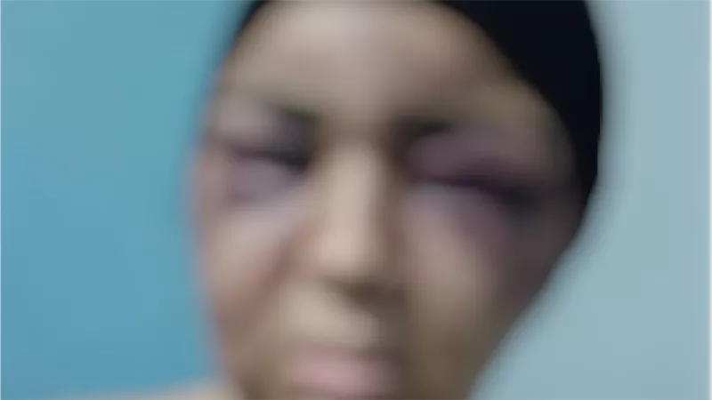 واقعة اعتداء زوج على زوجته بـ«حديدة» بالفيوم يثير الغضب.. والأمن يتحرك