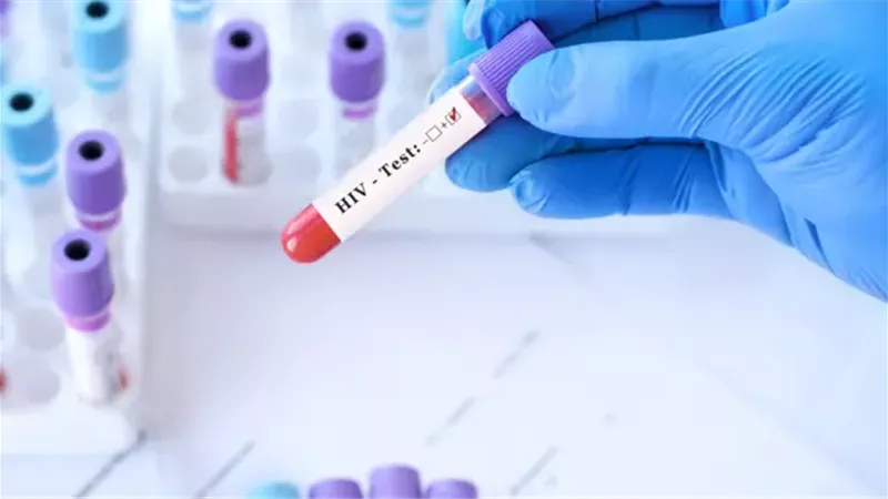 الإيدز.. كيف حول العلم مرضًا قاتلًا إلى حالة مزمنة يمكن التعايش معها ؟