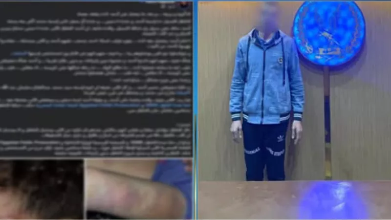 «ابني وبأدبه».. الأمن يكشف تفاصيل التعدي على طفل بالضرب وإصابته في الجيزة 
