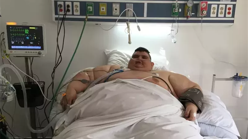 وفاة أثقل رجل في العالم بسبب عدوى في الكلى عن عمر 41 عاما