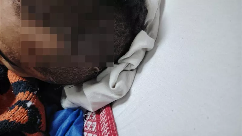 «خراريج بالمخ».. مدير مستشفى الهرم عن واقعة إهمال طبي «هرد في النيابة»|خاص