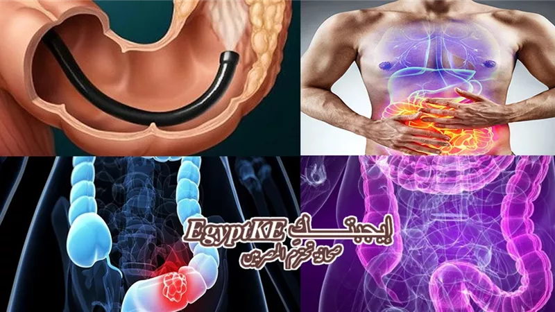 علاج القولون بين الأدلة العلمية والخرافات الشائعة