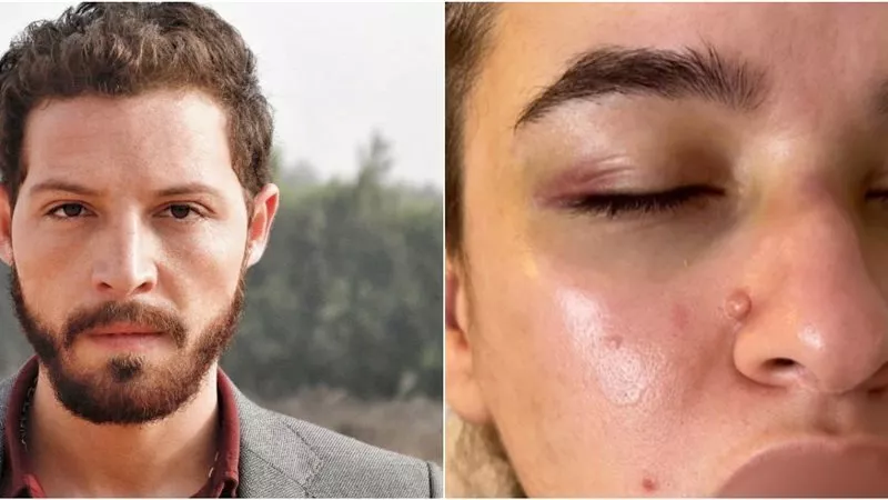 بعد اتهام الفنان محمود حجازي بضرب زوجته.. استشاري صحة نفسية يوضح السبب|خاص