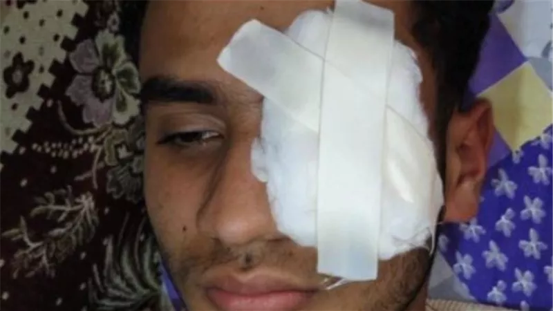 المشدد 10 سنوات على «كوارشي» أفقد شابا إحدى عينيه بالغربية