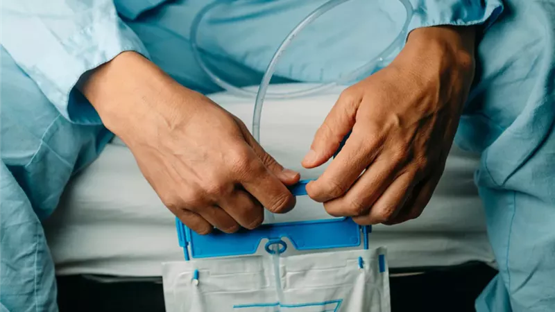 كيف يتطهر مريض القسطرة وما حكم صلاته؟.. دار الإفتاء تجيب