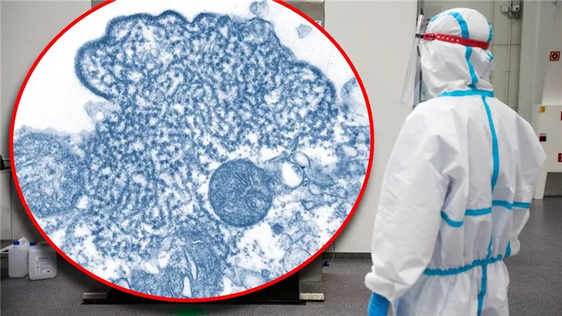 يسبب أمراضا خطيرة ويقتل.. فيروس نيباه يثير القلق مجددا.. اعرف أعراضه