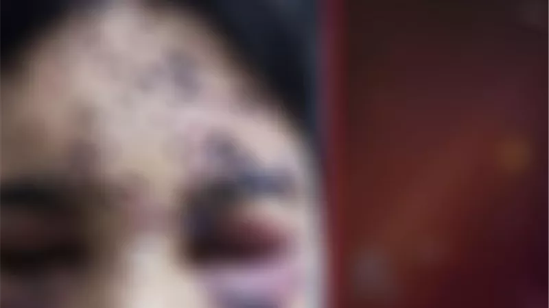 لم تسلم منهم البراءة.. طفل كردي يفقد عينه في احتجاجات إيران