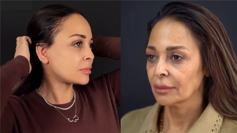 «أنا لسه صغيرة».. داليا البحيري تعلن إجراءها عملية تجميل| صور