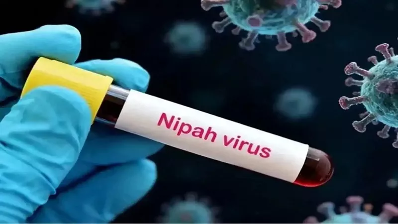 طبيب أمراض مناعية: فيروس جديد يهدد الصحة العامة ونسب وفياته تصل لـ55%