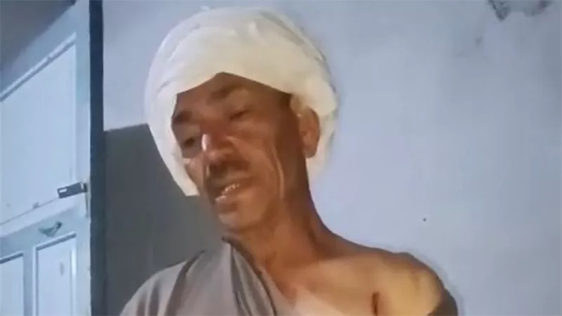 ذئب مفترس يهاجم مزارعا بالأقصر.. «قطع له أوتار يده»| تفاصيل