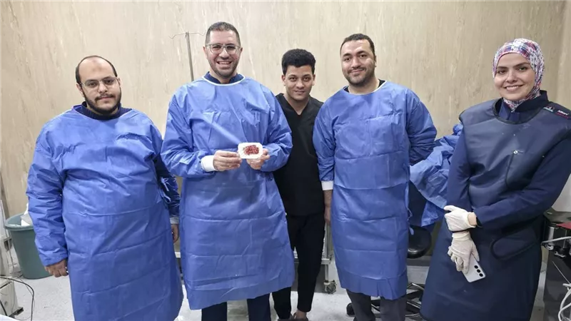 إنجاز طبي في مستشفيات جامعة بني سويف باستخدام المنظار المتقدم