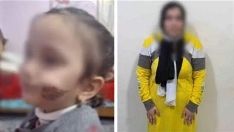 القبض على أم بعد ضرب طفلتها وحرق وجهها بكفر الشيخ
