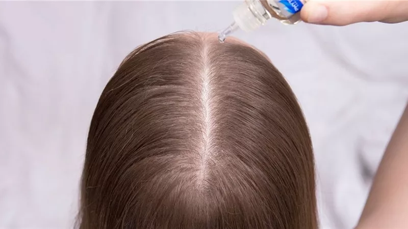 طرق تنظيف فروة الرأس من أجل شعر صحي