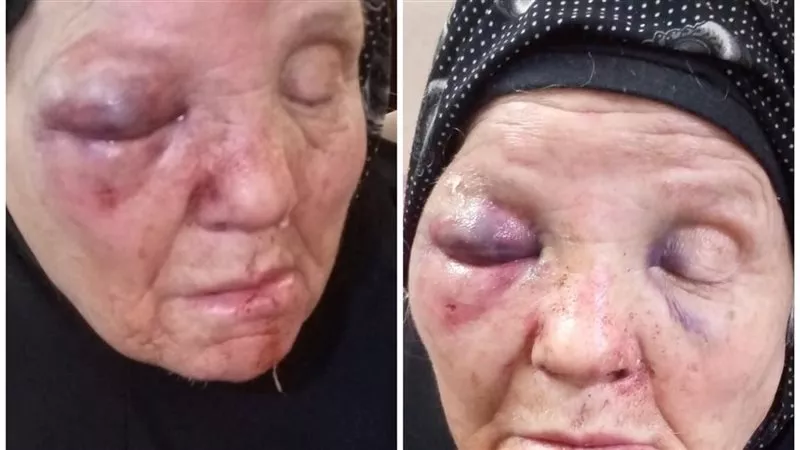 ضبط شاب بتهمة التعدي على والدته المسنّة في زفتى