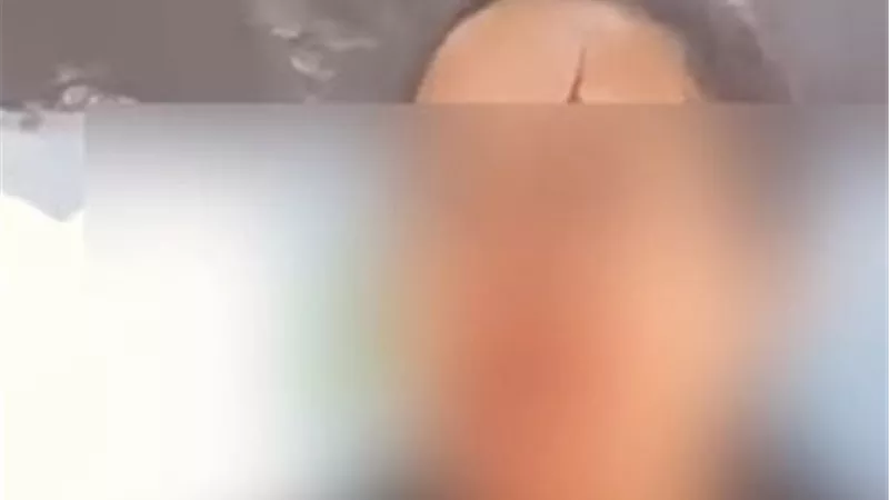 خناقة بين أولياء الأمور أمام مدرسة تتسبب في إصابة سيدة بدار السلام