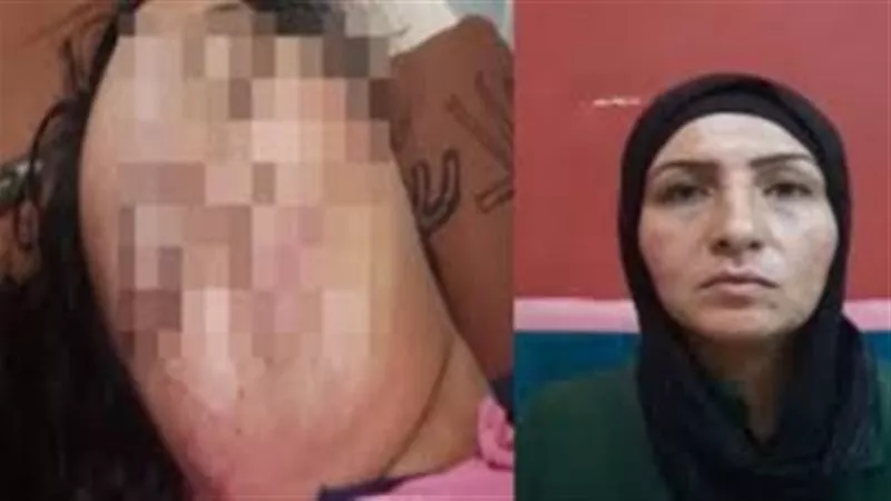 حبس المتهمين 4 أيام.. والدة طالبة الهرم المصابة لـ«إيجبتكِ»: بيكلموني عشان أتنازل