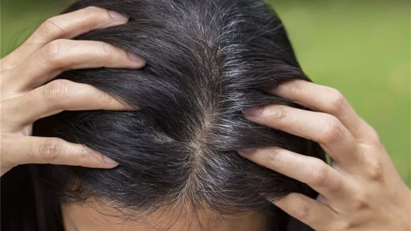 بدون صبغة.. حلول طبيعية لإخفاء الشعر الأبيض 