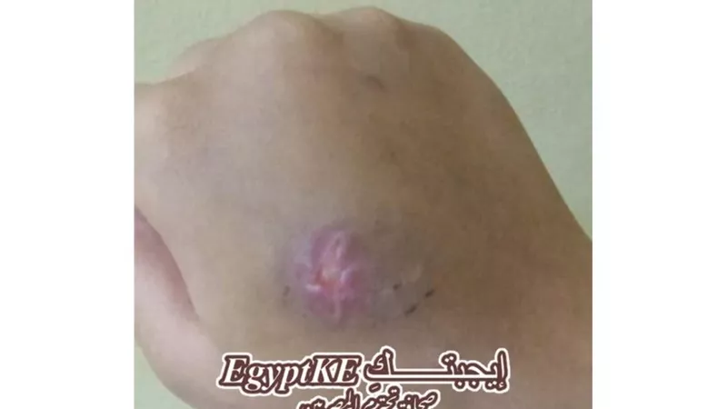والدة الطفلة المعتدى عليها أمام مدرسة بالهرم لـ«إيجبتكِ»:7 أيام ولم يلتئم الجرح
