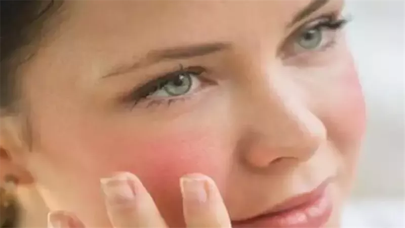 احمرار الوجه عند الخوف.. لماذا يحدث وكيف يمكن السيطرة عليه؟