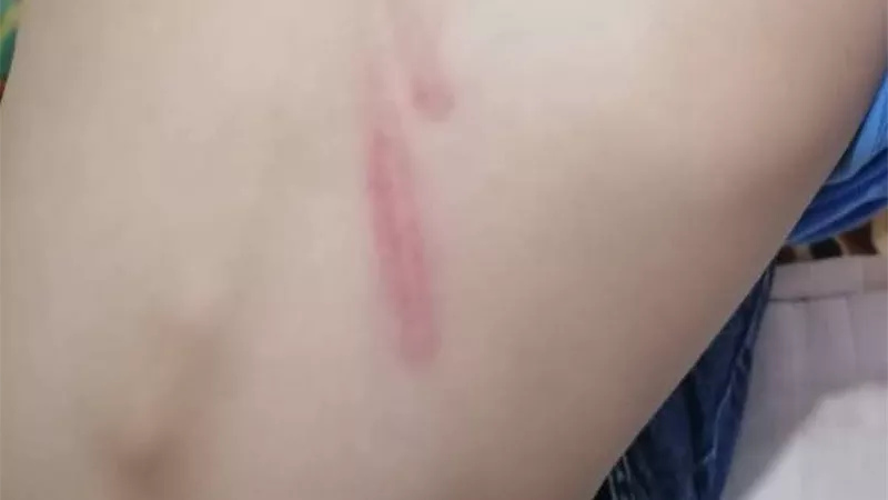 ولي أمر يشكو مدير مدرسة لاعتداءه على نجله بشبين القناطر.. وتعليم القليوبية توجه بفتح تحقيق 