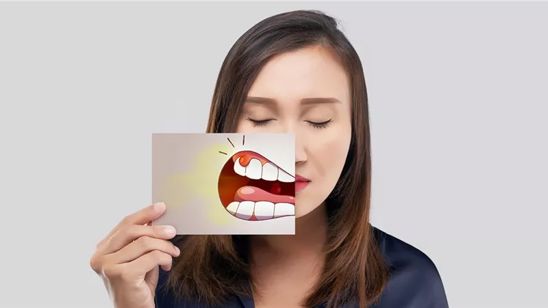 العثور على البكتيريا المرتبطة بأمراض اللثة