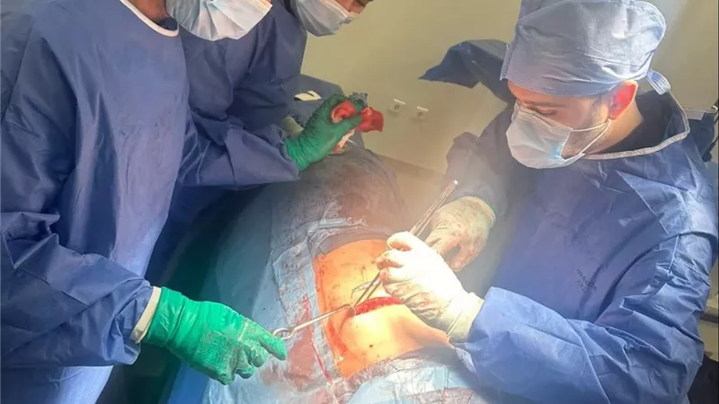 نجاح فريق طبي بجامعة بنها في إنقاذ حياة مريضة من ضيق حرج بالشرايين التاجية
